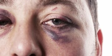 توندوتیژی دژ بە پیاوان